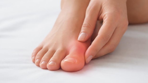 Burning sensation in big toe with redness and discomfort in close-up foot