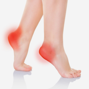 Illustration highlighting pain in the heel and arch associated with plantar fasciitis.
