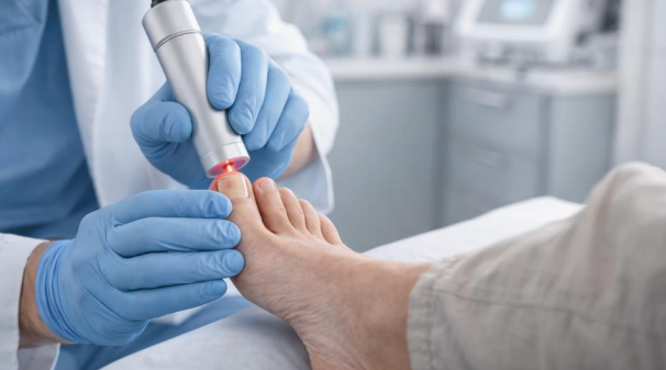 Laser treatment for toenail fungus performed by a podiatrist in a clinical setting